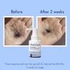 WishCare Hair Growth Serum with Rosemary, Redensyl, Anagain, Baicapil, Caffeine,