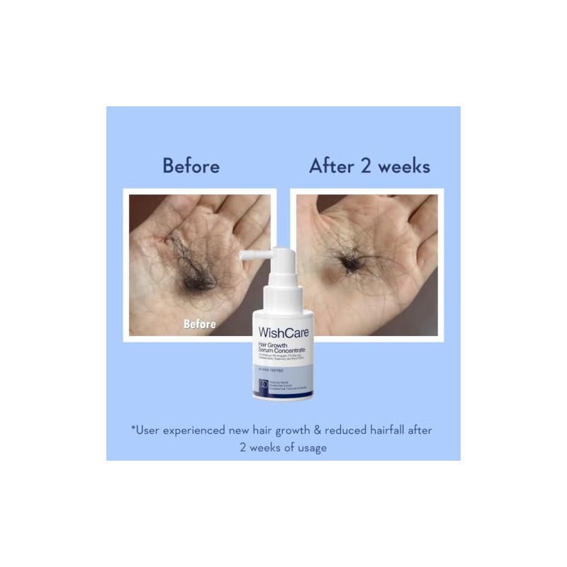 WishCare Hair Growth Serum with Rosemary, Redensyl, Anagain, Baicapil, Caffeine,