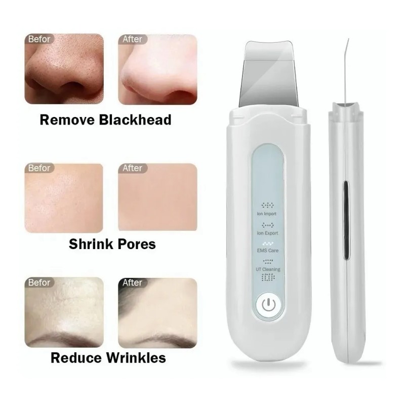 Kit De Eliminación De Acné, Ems, Fregador, Facial 3
