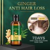 2PCS Lidoria Ginger Anti Hair Loss, Ginger Anti Hair Loss
