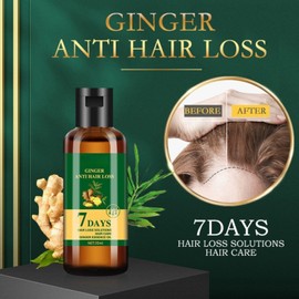 2PCS Lidoria Ginger Anti Hair Loss, Ginger Anti Hair Loss Oil, Lidoria Hair Growth Oil, ginger oil for Hair Growth, ginger hair Growth Serum, Nourishes hair Roots