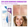 15% Acid Spot Cream with Face Cleanser,Acne Treatment Cream Set,Fast