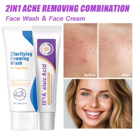 15% Acid Spot Cream with Face Cleanser,Acne Treatment Cream Set,Fast Acting Spot Treatment,Dark Spot Remover for Face,Reduces Blemishes & Breakouts,Gentle Skin Care Pimple Crea-m (2PC-Acne Set)