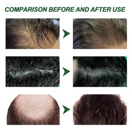 300ml Scalp Care Shampoo,Selen/ium Sulfi/de Shampoo,Oil Control Refreshing Anti-Dandruff Cleansing Shamp/oo,Anti-Dandruff Shampo/os,Hair Care Shampo/os,Dandruff Scalp Treatment