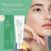 Creme De Ácido Azelaico Essência Facial 30g Anti-acne
