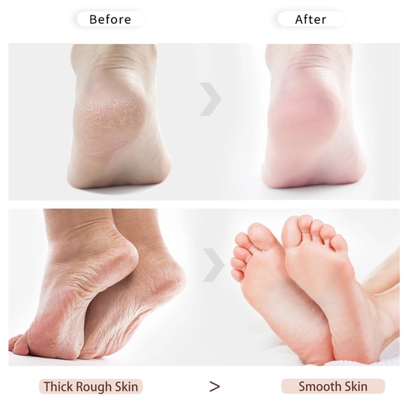2 PCS Double-Sided Pumice Stone for Feet, Foot Scrubber，Effective Pedicure
