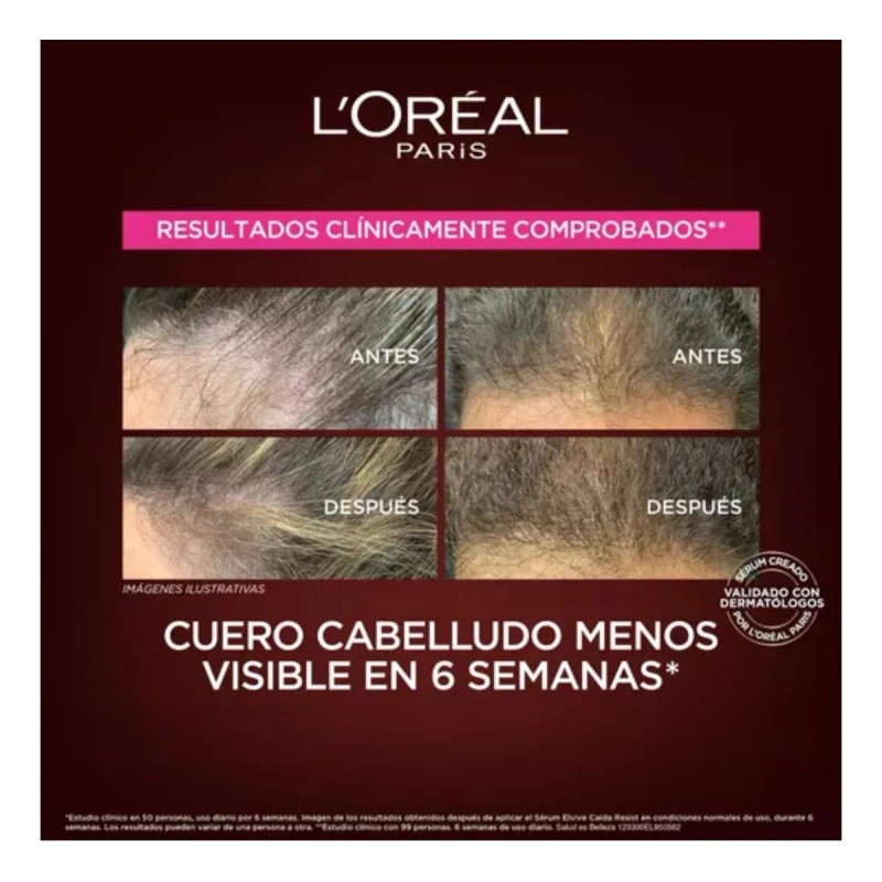 L'oréal Paris Serum Capilar Antiquiebre Con Aminexil 102ml