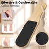ACWOO Callus Remover, Callus Removal Foot, Double-Sided Foot File for