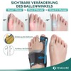 TENICORE Hallux Valgus Correction with 2 Angle Irons Toe Separator