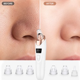 Professional Blackhead Vacuum for Pore Care – Rechargeable Facial Suction Tool for Home Skincare Routine