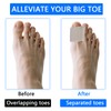 BOXOB 6pcs Gel Toe Separators for Women and Men, Big