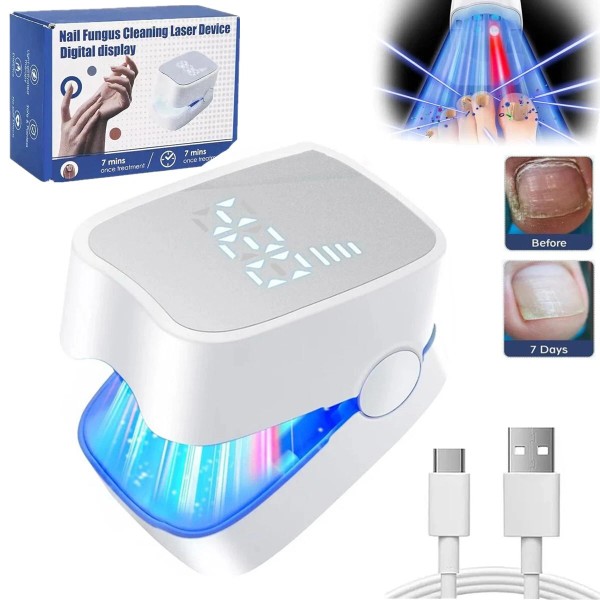 Unbranded Nail Fungus Laser Treatment Device for Multiple Toenail Onychomycosis