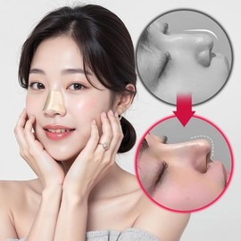 Nose heightening device, lifting band that shapes the nose and tightens elasticity, and nostril reduction band / 코높이 기구 코모양 탄력 잡아주는 리프팅 콧볼 줄이기 밴드