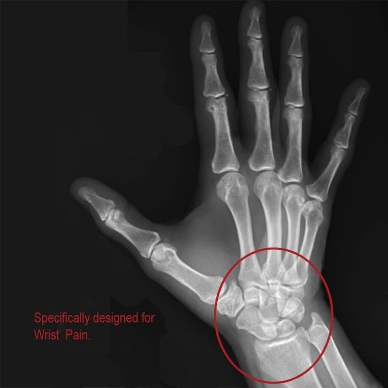 Comfort Cool D-Ring Wrist Brace. Indications - Carpal Tunnel, Tendonitis,