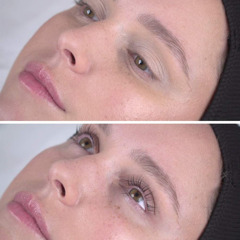 Lash FX Large Lifting Rods