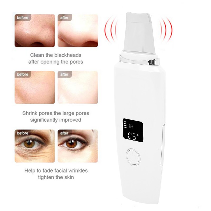 Ultrasonic Facial Skin Scrubber Blackhead Removal Face Cleaning Spatula Household