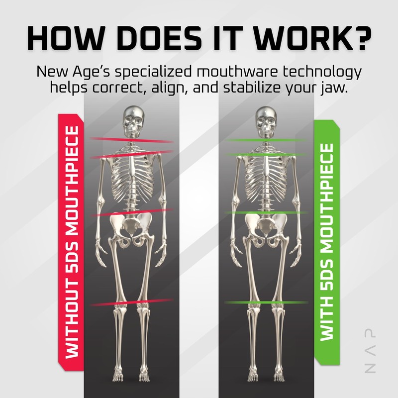 New Age Performance 5DS Core Mid Profile Fitness Mouthpiece, Enhance