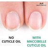 Aceite De Cutícula Para Uñas Tamaño De Recambio Para Cutículas