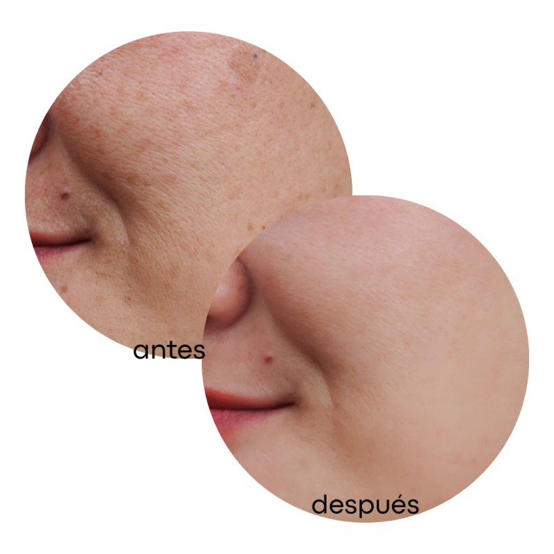 Exfoliante Aclara, Desmancha, Elimina Células Muertas 60 Ml Todo Tipo