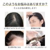 HIYE 部分ウィッグ 頭頂部 女性 人毛100% 手植え ポイントウィッグ リアル 分け目 人工肌