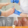 Treatonic Tratamiento de uñas encarnadas – Kit de alivio del
