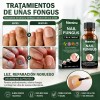 Eelho Líquido Para Hongos En Uñas Cura Hongos Y Onicomicosis