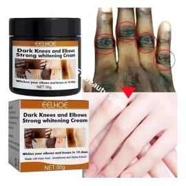*/crema Iluminadora De Nudillos Oscura Para Manos, Codos Y R