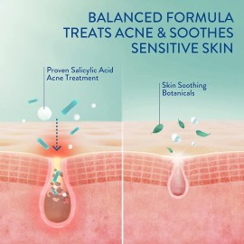 Crema Hidratante Cetaphil Gentle Clear para Piel Grasa con Acné | Efecto Mate | Ácido Salicílico 0.5% | 89ml | Hipoalergénica y Libre de Aceites