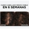 Shampoo Y 2 Serum Anticaida Loreal Aminexil Para 60 Días