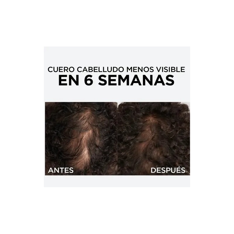 Shampoo Y 2 Serum Anticaida Loreal Aminexil Para 60 Días