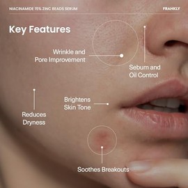 FRANKLY Suero de Niacinamida 15% + Perlas de Zinc | Reparación de la piel de dosis alta pero suave | Control del acné, poros y enrojecimiento | Sistem