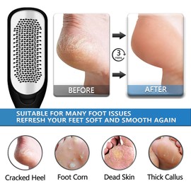 Foot File Colossal Foot Rasp Two-side Callus Remover, ACVVIP Stainlaess Steel Foot Scrubber Pedicure Foot Care to Remove Callus, Foot Corn, Dead Skin & Cracked Heels