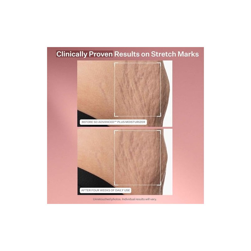 Strivectin Anti Wrinkle Trio Kit para Rostro y Ojos: Set