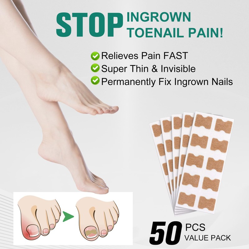 Pack of 50 Toenail Correction Patches for Ingrown Toenails -