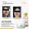 Crema Facial Y Corporal Despigmentante Seca Noche