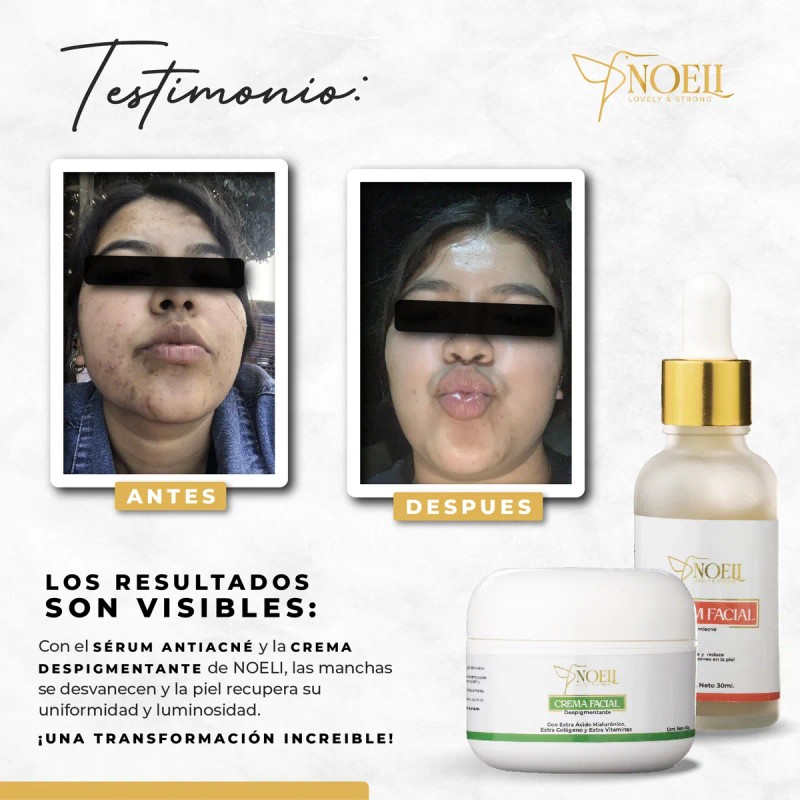 Crema Facial Y Corporal Despigmentante Seca Noche