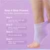 Glowxie Moisturising Gel Heel Socks for Cracked Heels - 2x