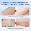 Lanisty Crema De Urea Al 40% Para Pies Agrietados -