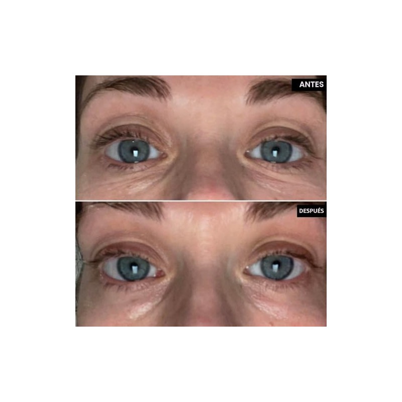 The INKEY List Brighten-i Eye Cream