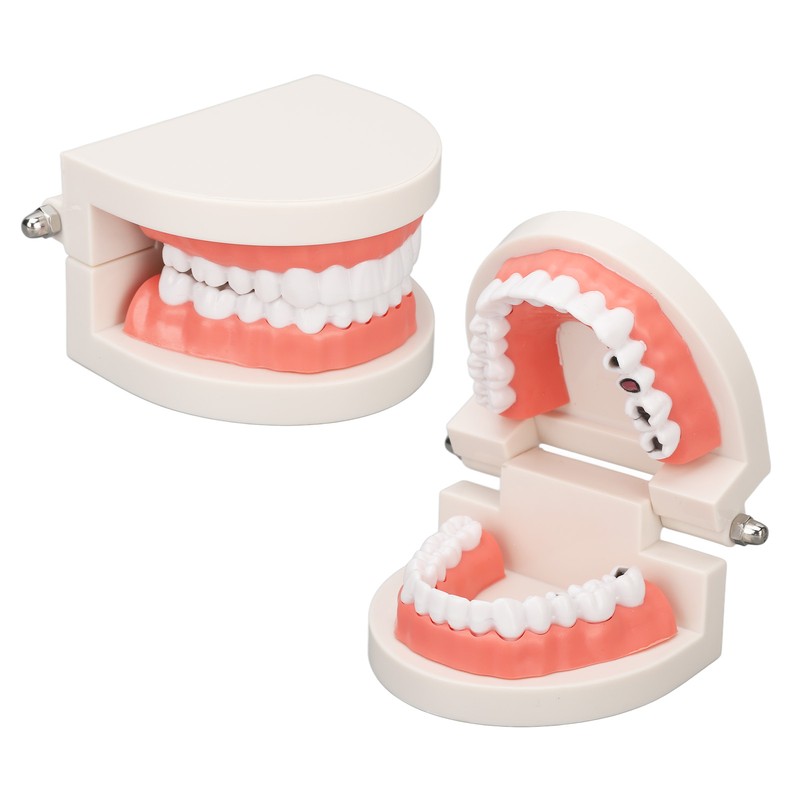 Dental Disease Caries Teeth Model Resin Simulation Teaching Prop Dental