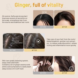 QUARXERY Shampoo Anticaída Ginger Pro Shampoo y Cabello Graso con Jengibre - 240ml                                                                    