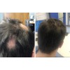 Shampoo Reviving Farmasi Caida Cabello