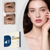 Parches De Protección Ocular Hidratantes Y Calmantes Zh Xq