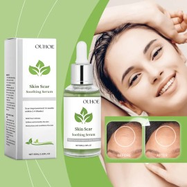 Sérum Ligero Ouhoe Para El Cuidado De La Piel Y Cicatrices,