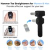 yilenxuri Hammer Toe Straightener with Removable A luminum Splint，2pcs
