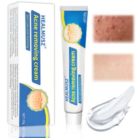 20g Aknecreme, Pickelcremefür das Gesicht, Feuchtigkeitsspendende Anti-Akne-Creme Verfeinert das Hautbild, Bei Akne und Hautunreinheiten Schonende Pflege Haut