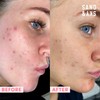 Sand & Sky Flash Perfection Exfoliating Treatment Face Scrub -