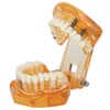 1pc Orange Color Dental Disease Removable Study Teaching Teeth Model