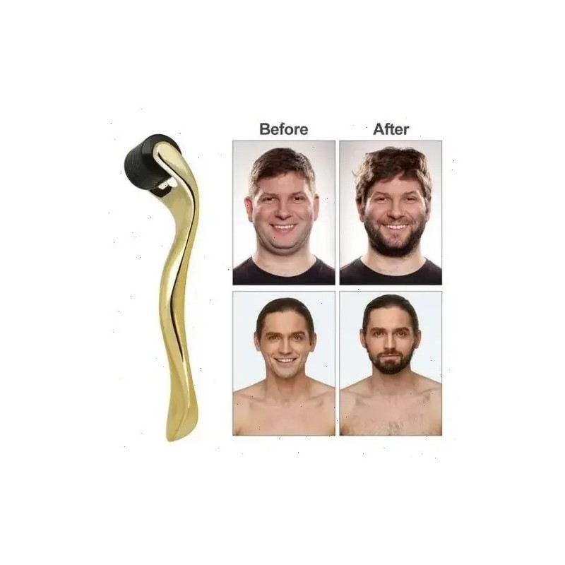 Derma Roller De 1 Mm Facial Cabello O Rodillo Para