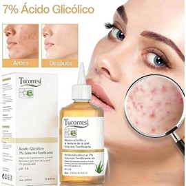 Tónico Facial con Ácido Glicólico al 7%: Exfoliante Químico para Puntos Negros, Poros y Acné - 240ml para Piel Grasa y Mixta, Elimina Manchas y Arrugas, Regalo Skincare para Mujer